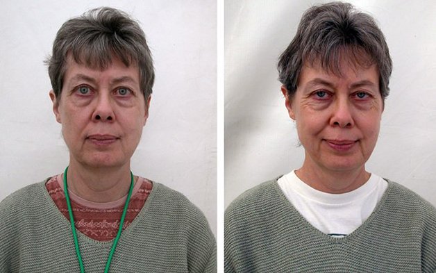 Fotógrafo registra antes e depois de pessoas praticarem meditação e diferença é evidente