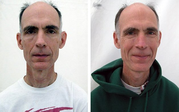 Fotógrafo registra antes e depois de pessoas praticarem meditação e diferença é evidente