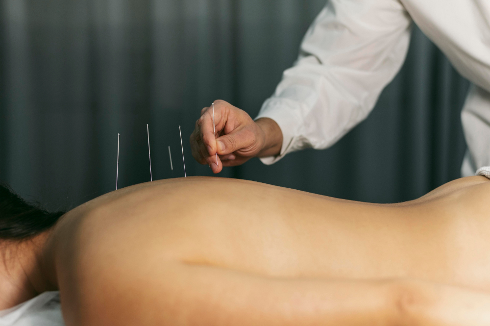 acupuntura para ajudar na fertilidade