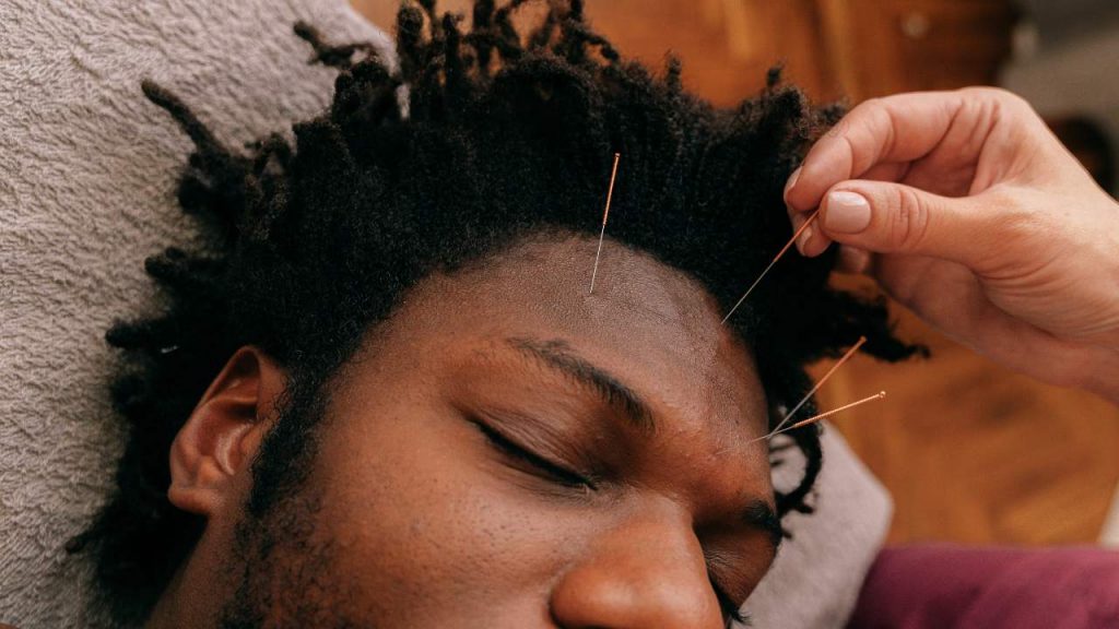 Você sabia que a acupuntura reduz dores de cabeça crônicas?