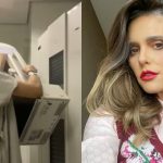Fernanda Lima compartilha exame de mamografia: “Se cuidem, mulheres”