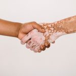 Dia Nacional dos Portadores de Vitiligo: entenda mais sobre a condição
