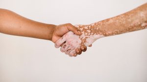 Dia Nacional dos Portadores de Vitiligo: entenda mais sobre a condição