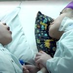 Equipe médica brasileira se torna referência após conseguir separar gêmeos unidos pelo crânio
