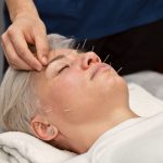 Fique atento: prática da acupuntura deve se restringir a médicos especializados