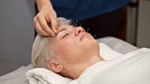 Fique atento: prática da acupuntura deve se restringir a médicos especializados