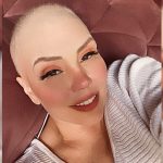 "Careca não me remete mais à doença, mas à cura", diz Simony sobre câncer