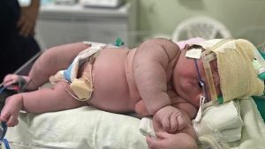 Já nasceu com 7,3 kg: maior bebê do Amazonas bate recorde no estado