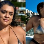 Preta Gil quebra tabus e exibe cicatriz após retirada de bolsa de ileostomia