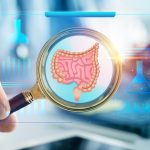 Câncer de intestino: SUS adota novo exame que detecta a doença antes dos sintomas